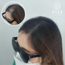 하이스칼프 이미지