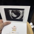 6월 모지일기 [260525 - 260607]