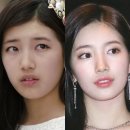 J헤어라인