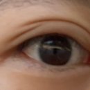 참빛안과의원 이미지