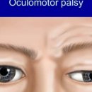 연세바른안과의원 이미지