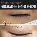 아이레이저랩 이미지