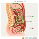 소아탈장수술비보장 특별약관(보험금의 지급사유) 이미지