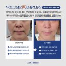 스페셜핏 이미지