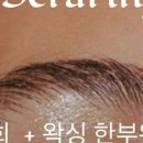 링 에스테틱 이미지