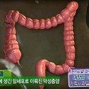 대장암을 이긴 기적의 마늘 밥상 이미지