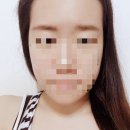 Brown Skin(브라운스킨) 이미지
