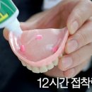 이거시 알고싶다-치아가 상실되어 틀니를 쓰면 음식을 섭취할때 이빨이 빠져버리는 경우가 있는 데 잇몸에 틀니를 부착하는"틀니 크림"에 대해 이미지