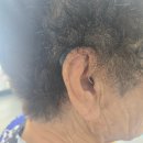 군산유니트론보청기 | 김제보청기, 80대 여성의 유니트론 목시 보청기 사용 후기 – 가족 대화·경로당·전화 통화 만족