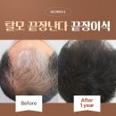 글로웰의원