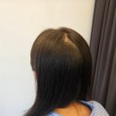 라이모플러스(LYMOPLUS) | 마곡 두피 탈모 커버 SMP ㅣ 라이모플러스 헤어라인·정수리 커버 시술 솔직 후기 (feat.강력추천🩷)