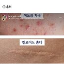 의사들이 추천하는 피부연고~^^ 이미지