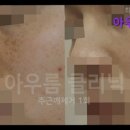 아우름의원 | [강남역 강남 피부과 추천] 아우름의원 피부과 전문의의 신뢰도