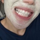 셀프 치아미백 내돈내산 크레스트 사용법 후기 2탄