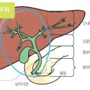 메트포르민 담도암에 효과(IGF-1 억제, AMPK 활성화).2019년 논문 이미지