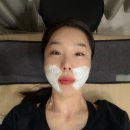 멍실장 | 원주 피부과 팔자주름 쥬베룩볼륨 전후 후기 남겨요