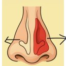비염 20년차에 터득한 비염 다스리는 방법 이미지