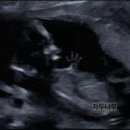 후둥 이미지