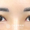 더블픽스