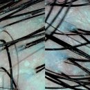 순수뷰티 - 서구 | 부산 두피케어 추천! 순수뷰티에서 헤드스파 받고 온 솔직 후기