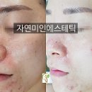 자연미인에스테틱 이미지