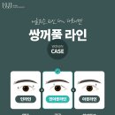 원진성형외과 네이버블로그