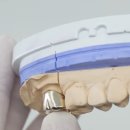 덴트리온 이미지