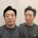 서울 젠틀맥스프로플러스 피부과 전문의 후기?