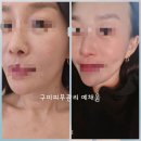 구미피부관리 예채움 에스테틱 물방울관리 두피케어까지 완벽 !