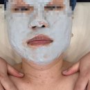 레이디폼 | 천안 피부관리 추천 . ‘더레이디 뷰티’ 모공관리로 광채 되찾은 후기