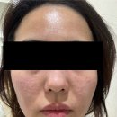 뷰티온의원평택고덕점 | 평택 고덕 뷰티시술전문 피부과 뷰티온의원 평택고덕점