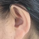 우정의료기기 | 포천보청기 7년간 난청 방치가 부른 비극, 오티콘보청기로 해결