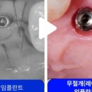 에이(A)플란트치과의원 이미지