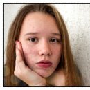 피부관리 이미지