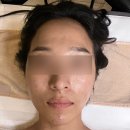 미인옷장 | 모종동 피부관리 잘하는 곳, 아낌없이 주는 미인백서 수분관리 후기
