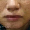 리뉴미피부과 이미지