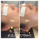 부산트로이필 연산동피부관리 겨울철 건조 피부 개선 플라소닉 피오니스킨앤바디