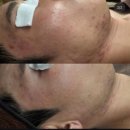 양에스테틱 네이버블로그