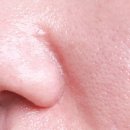 UV메디칼 이미지