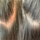 더봄약국 | 지루성 두피염 샴푸 약국 만족템 추천 후기