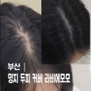 명지헤어라인