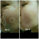 휴샵
