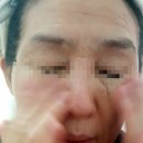 alva산돈오일이면 건성피부도 문제없어요