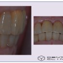 동의치과기공소 이미지