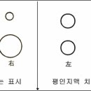 맥진