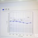 광주보청기 난청이명센터 | 광주 이명 난청 상담이 필요하다면 독일보청기