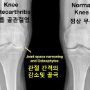 북부대동물병원 | 퇴행성 관절염과 골괴사, 영남대병원 진료 후기ㅣ어머니의 무릎, 가족을 위해 걸어온 50년