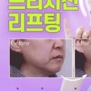 유투성형외과의원 이미지