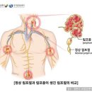D47.7 분류번호가 경계성종양으로 분류되는 질병입니까? 이미지