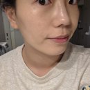 로데오로(1) | 압구정로데오피부과 미라젯 리투오 스킨부스터 솔직한 후기